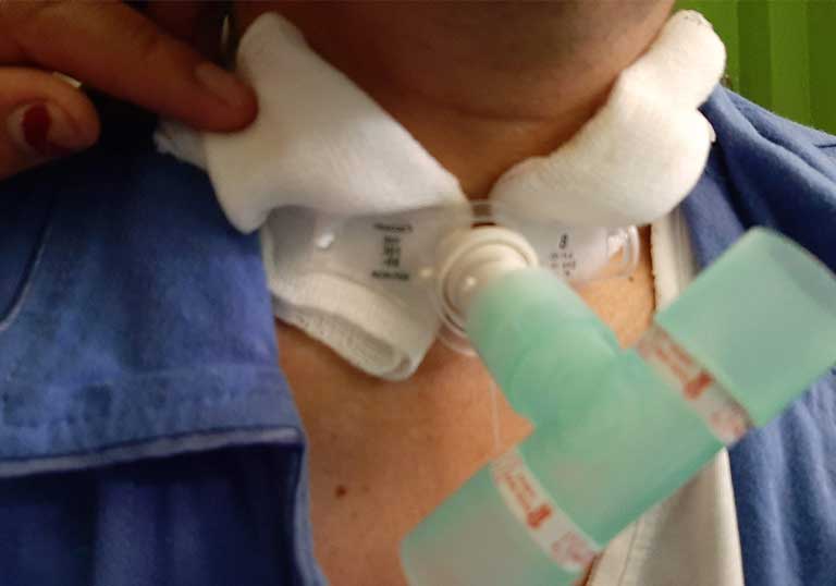 fisioterapia-respiratoria-1